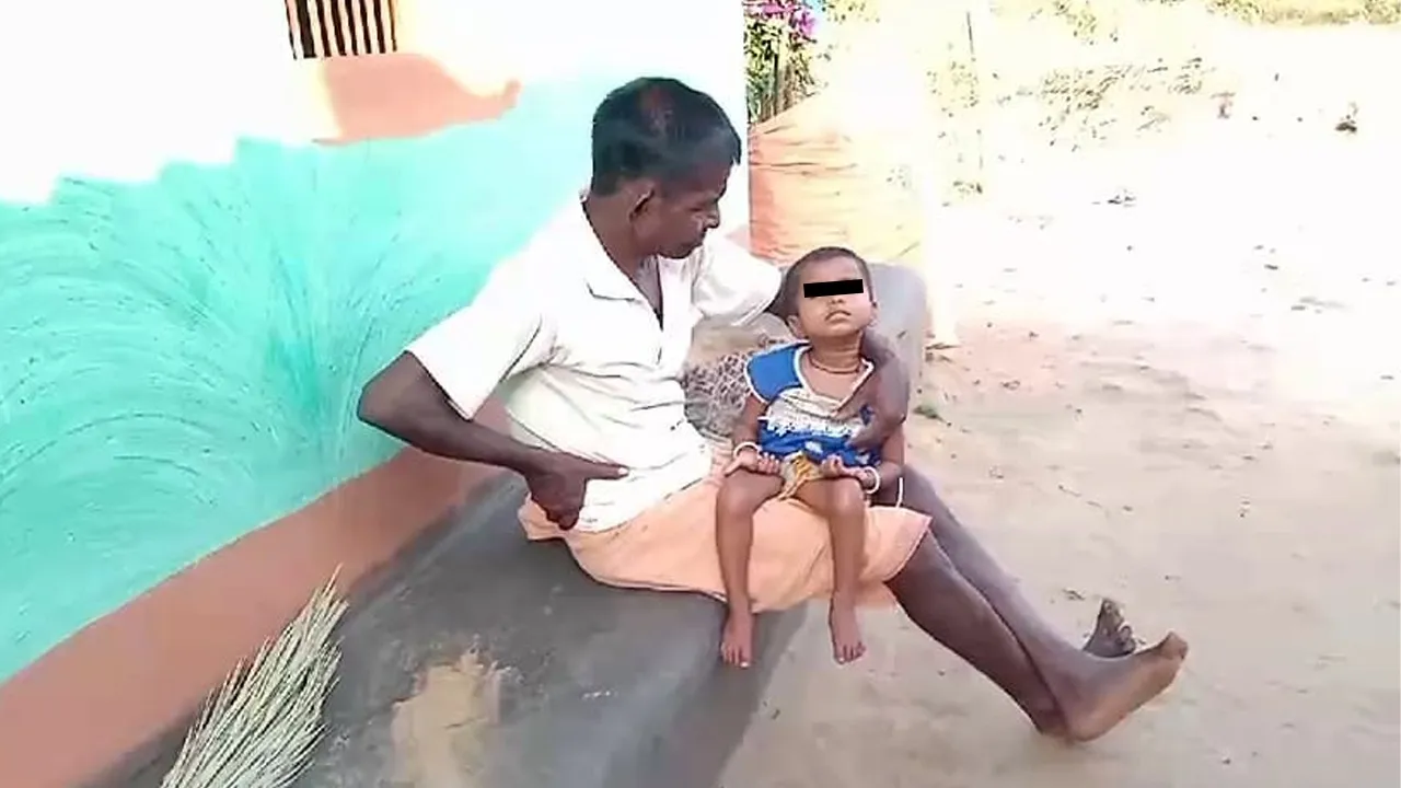  ଜନ୍ମରୁ ଦିବ୍ୟାଙ୍ଗ ପାଞ୍ଚ ବର୍ଷର ଶିଶୁକନ୍ୟା: ମଳତ୍ୟାଗ ବେଳେ ପାଉଛି କଷ୍ଟ
