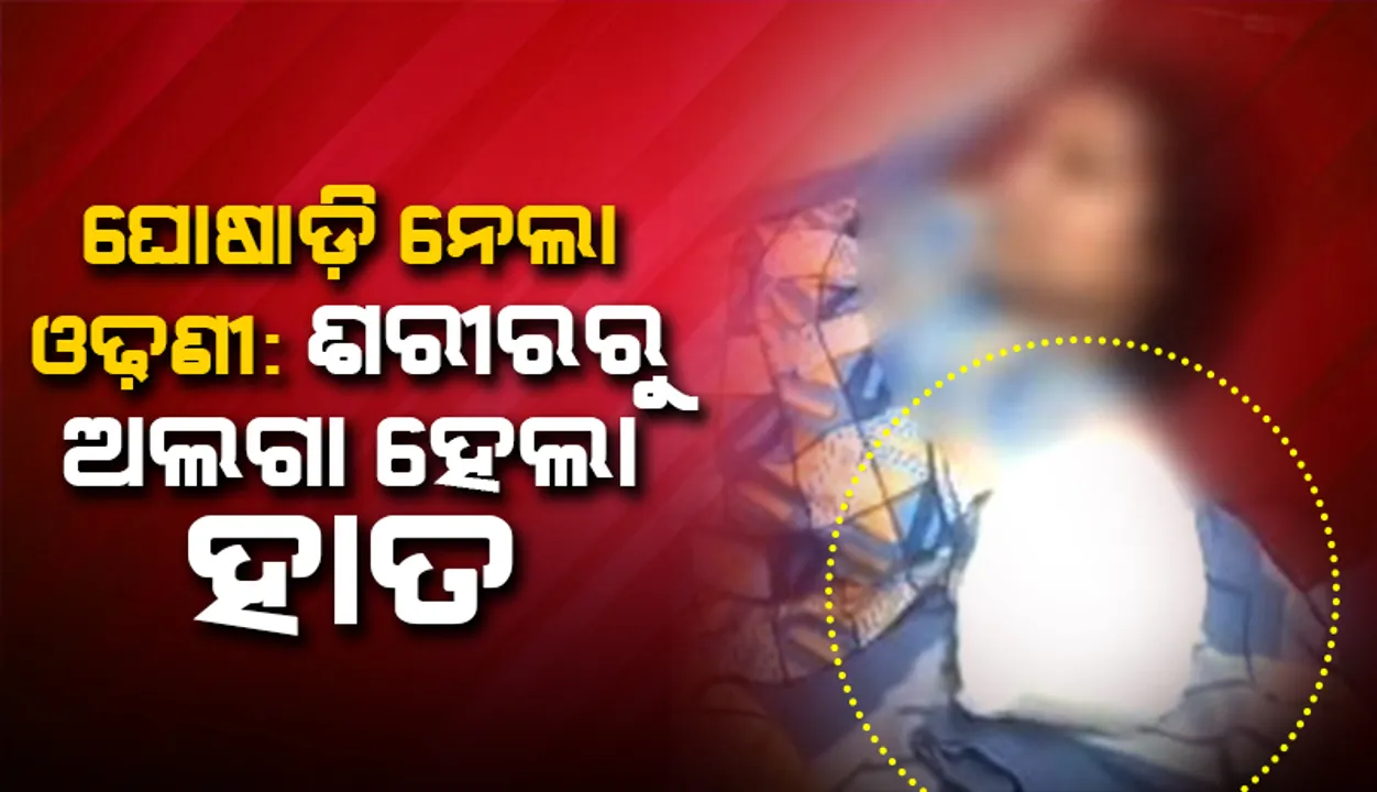  ଦୁର୍ଘଟଣାର ଶିକାର ହେଲା ମା’; ଶରୀରରୁ ଅଲଗା ହୋଇଗଲା ହାତ
