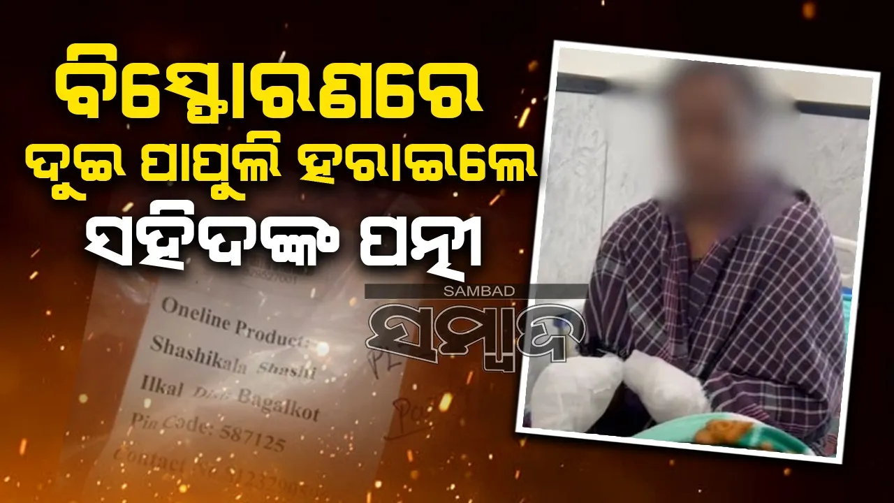  ସାଙ୍ଗ ପଠାଇଥିବା ହେୟାର ଡ୍ରାୟର ବିସ୍ଫୋରଣରେ ମହିଳା ହରାଇଲେ ହାତ