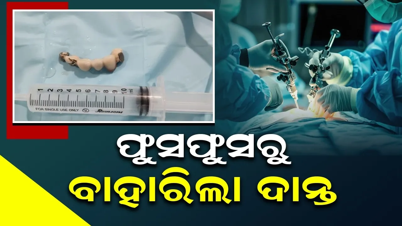 ଶୋଇଥିବା ଅବସ୍ଥାରେ ନକଲି ଦାନ୍ତକୁ ଗିଳି ପକାଇଲେ ବ୍ୟକ୍ତି