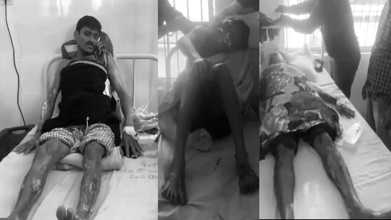  ମିଠା ‌ଦୋକାନରେ ଗ୍ୟାସ୍‌ ଲିକ୍‌ରୁ ଅଗ୍ନିକାଣ୍ଡ: ମାଲିକଙ୍କ ସହ ୩ ଗୁରୁତର