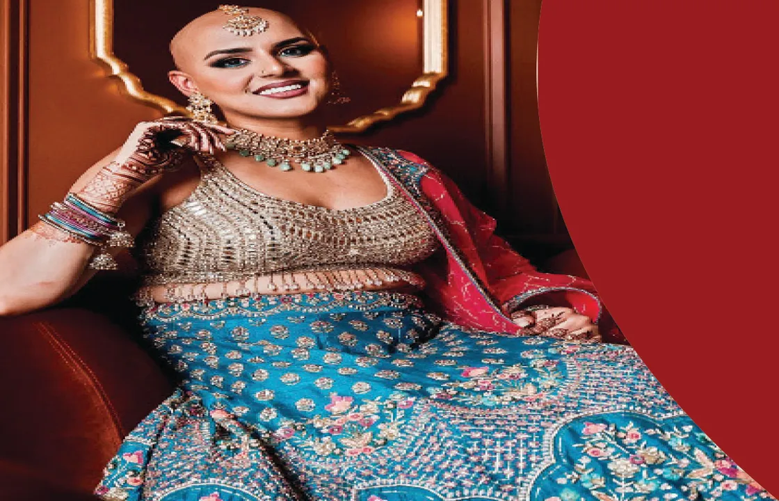  କେଶନିର୍ଭର ନୁହେଁ ସୌନ୍ଦର୍ଯ୍ୟ!