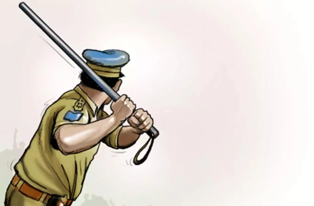  ଟାଙ୍ଗୀ ଥାନାରେ ଥାର୍ଡ ଡିଗ୍ରି! ପୁଲିସ ନିର୍ଯାତନାରେ ପୀଡ଼ିତଙ୍କୁ ମସ୍ତିଷ୍କଘାତ
