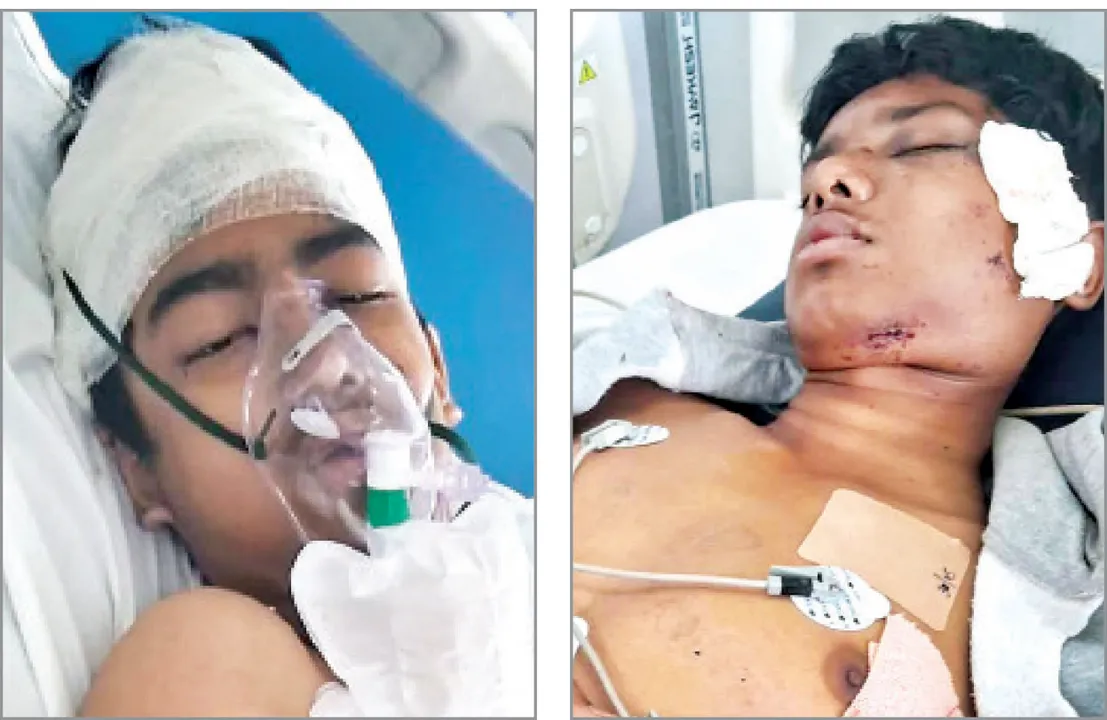  ସିକିମ୍ ଦୁର୍ଘଟଣା: ୪ ଦିନ ପରେ ବି ଇତିଶ୍ରୀଙ୍କ ପତ୍ତା ମିଳୁନି
