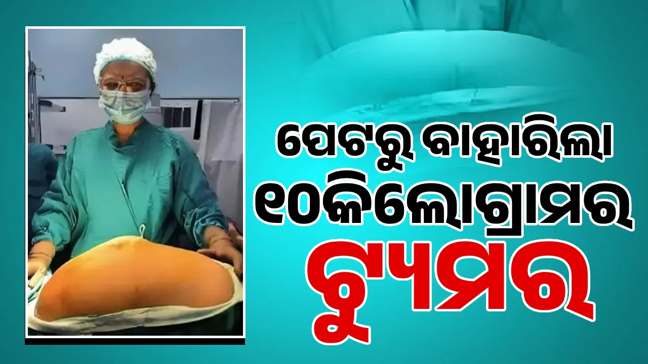  ପେଟରୁ ବାହାରିଲା ୧୦କିଲୋଗ୍ରାମ ଓଜନର ଟ୍ୟୁମର ଦ୍ବିତୀୟ ଜନ୍ମ ପାଇଲେ ମହିଳା