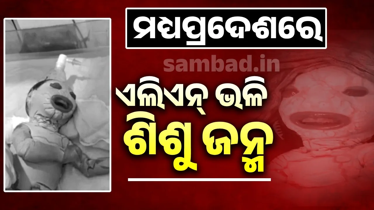  ମଧ୍ୟପ୍ରଦେଶରେ ଏଲିଏନ୍ ଭଳି ଶିଶୁ ଜନ୍ମ: ଚର୍ମରେ ଫାଟ ଓ ନିଶ୍ୱାସ ନେବାରେ ଅସୁବିଧା