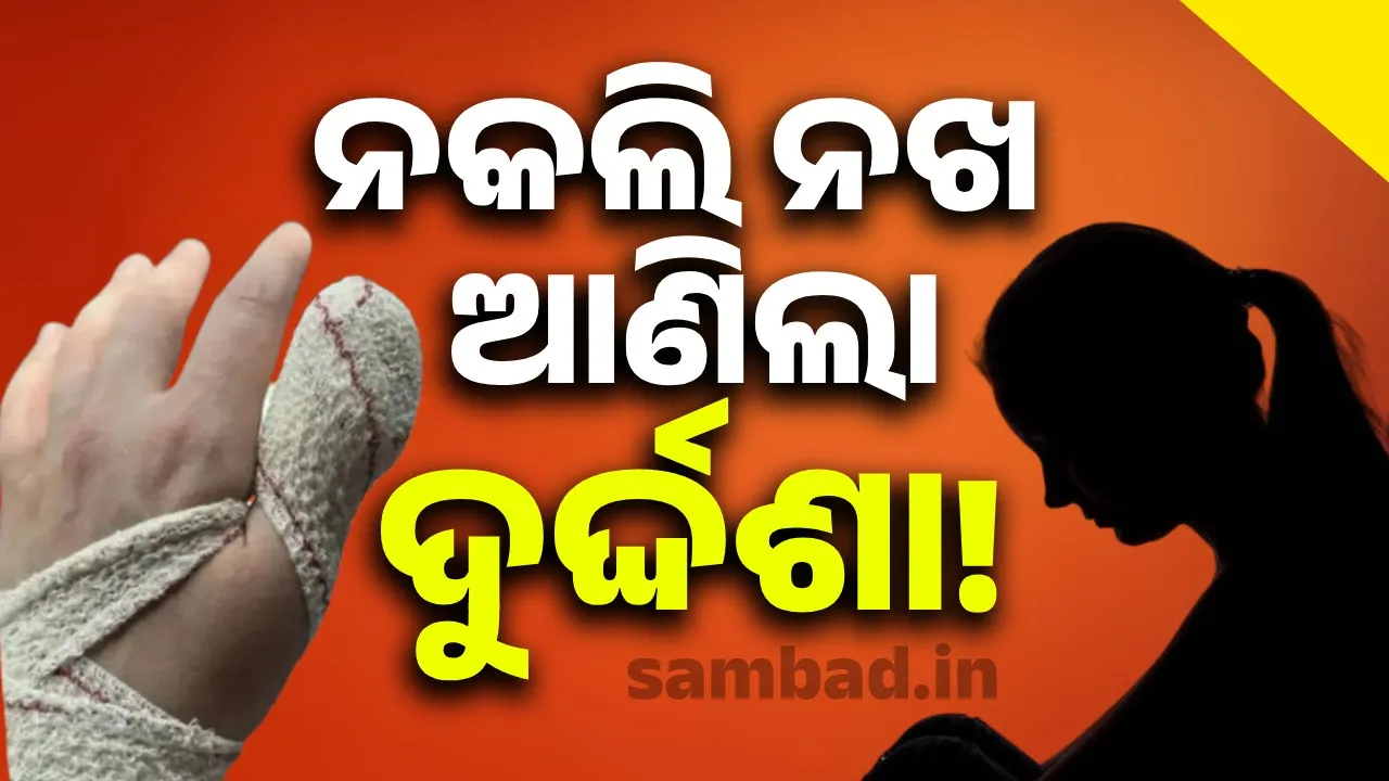  କୃତ୍ତିମ ନଖ ଲଗାଇବା ନିଶା ମହଙ୍ଗା ପଡ଼ିଲା: ମହିଳାଙ୍କୁ ନିୟମିତ କରାଇବାକୁ ପଡ଼ୁଛି ଚିକିତ୍ସା