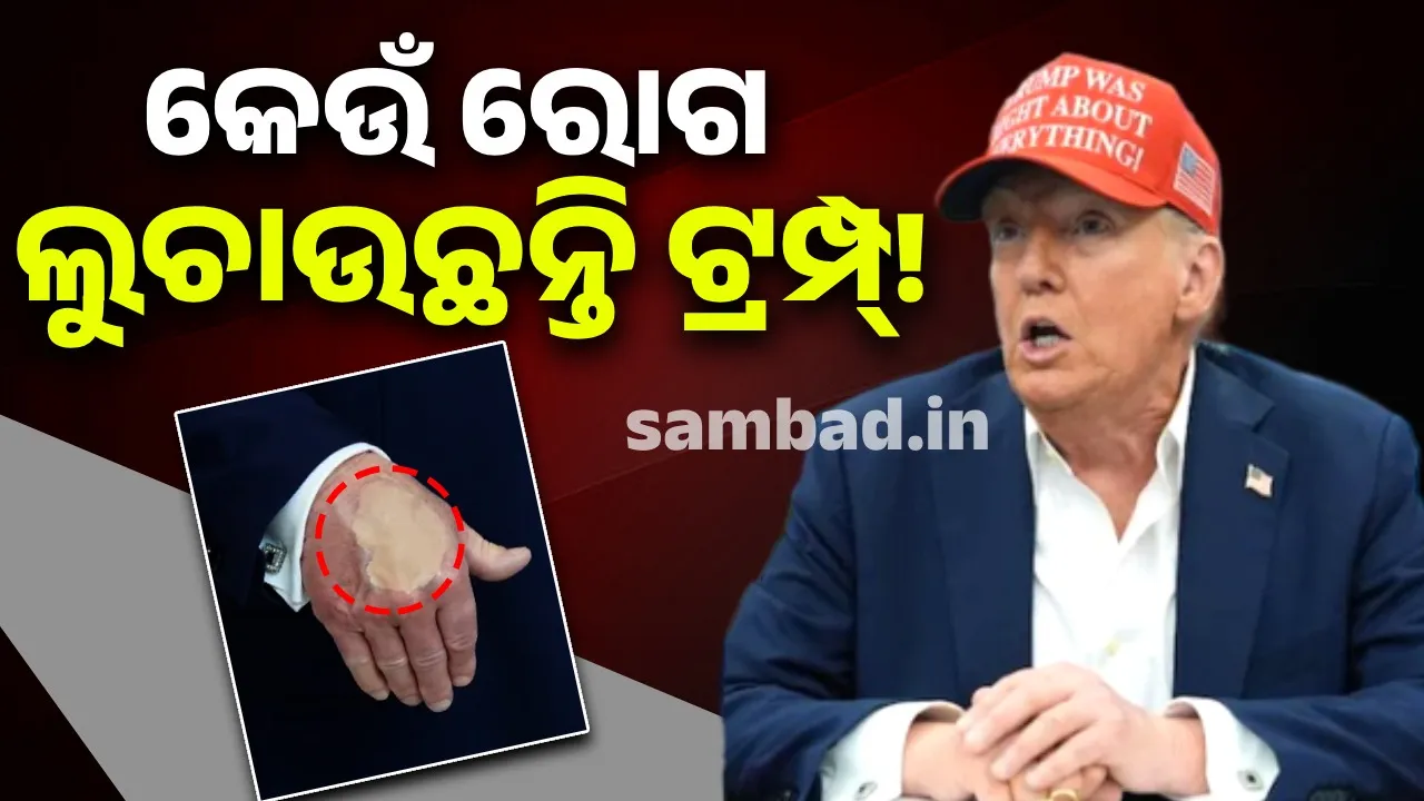  What happened to Trump's hands Photograph: (sambad.in) 