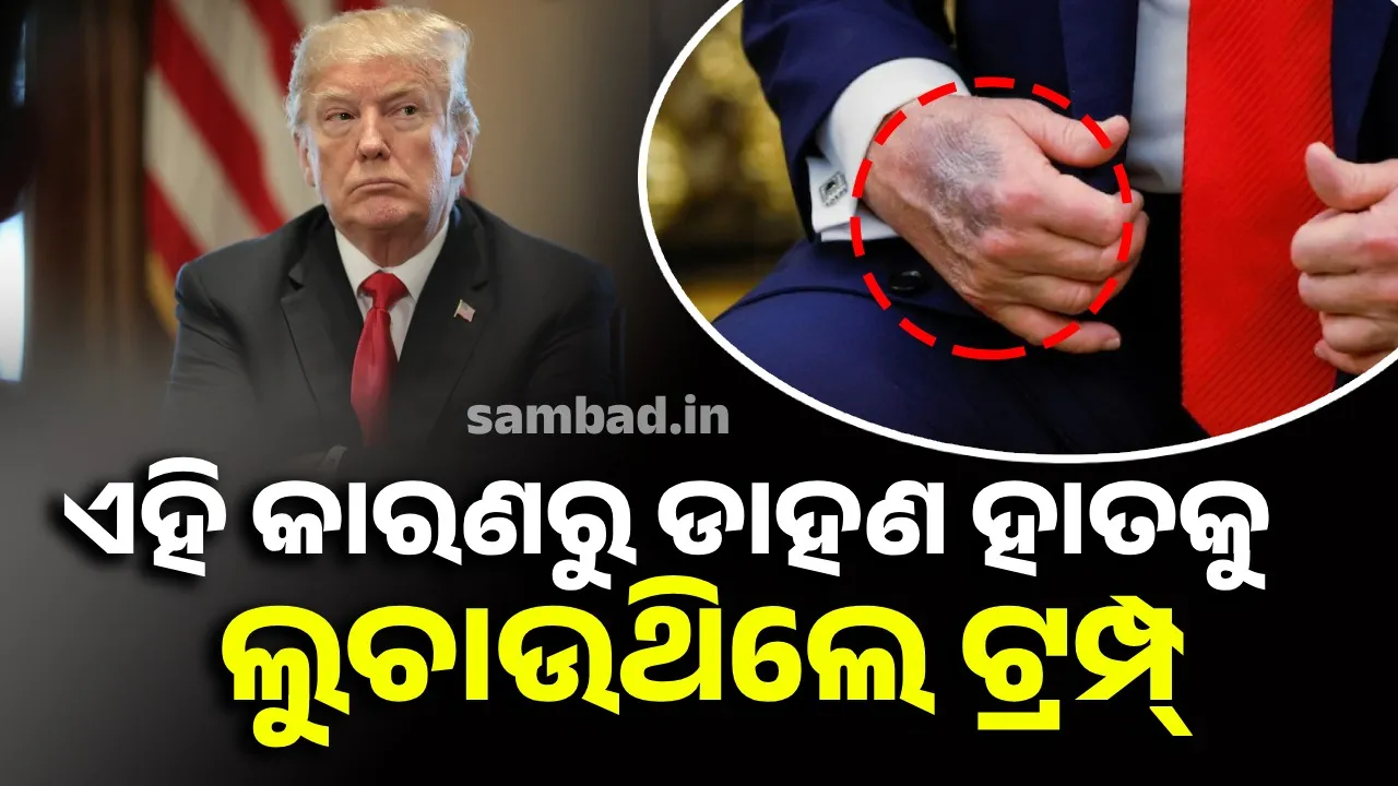  ହାତର ଚିହ୍ନକୁ ଲୁଚାଇବା ପାଇଁ ବାରମ୍ବାର ଚେଷ୍ଟା କରୁଥିବା ଟ୍ରମ୍ପ୍‌ କ୍ୟାମେରାରେ ଧରାପଡ଼ିଗଲେ