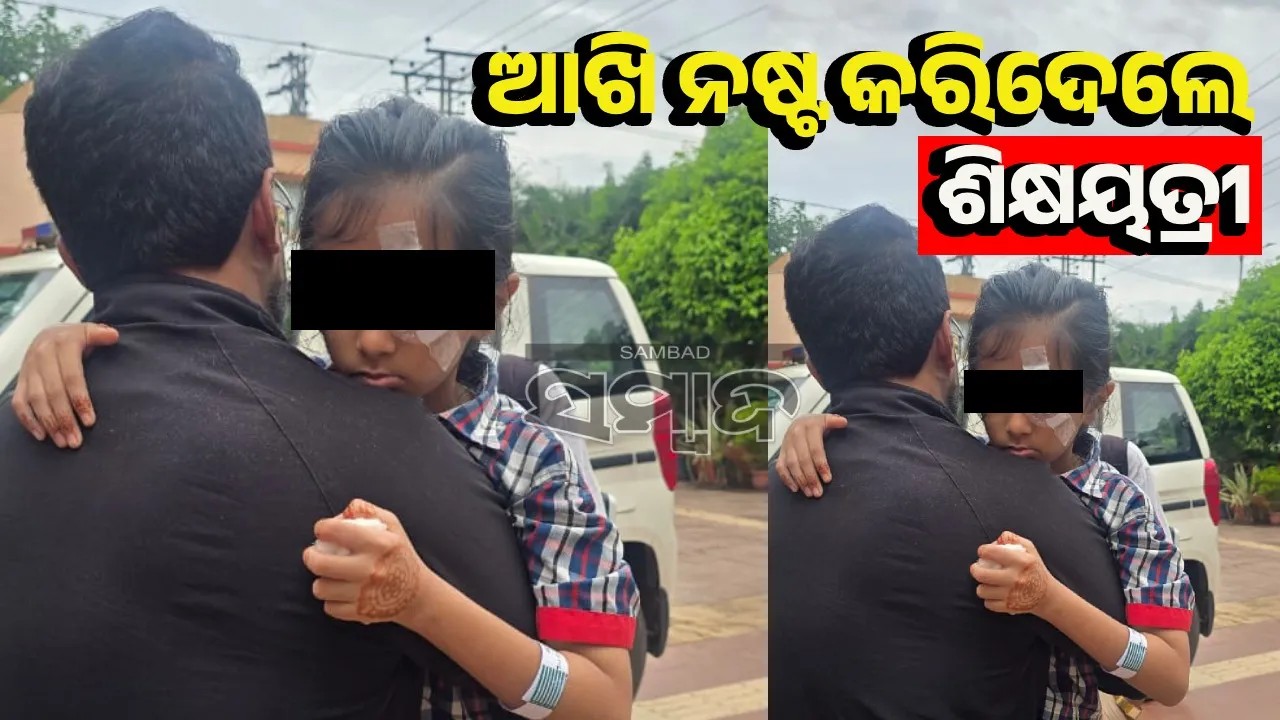  ସୀମା ଟପିଲା କ୍ରୋଧ: ମାଡ଼ ମାରି ଛାତ୍ରୀଙ୍କ ଆଖି ନଷ୍ଟ କରିଦେଲେ ଶିକ୍ଷୟିତ୍ରୀ