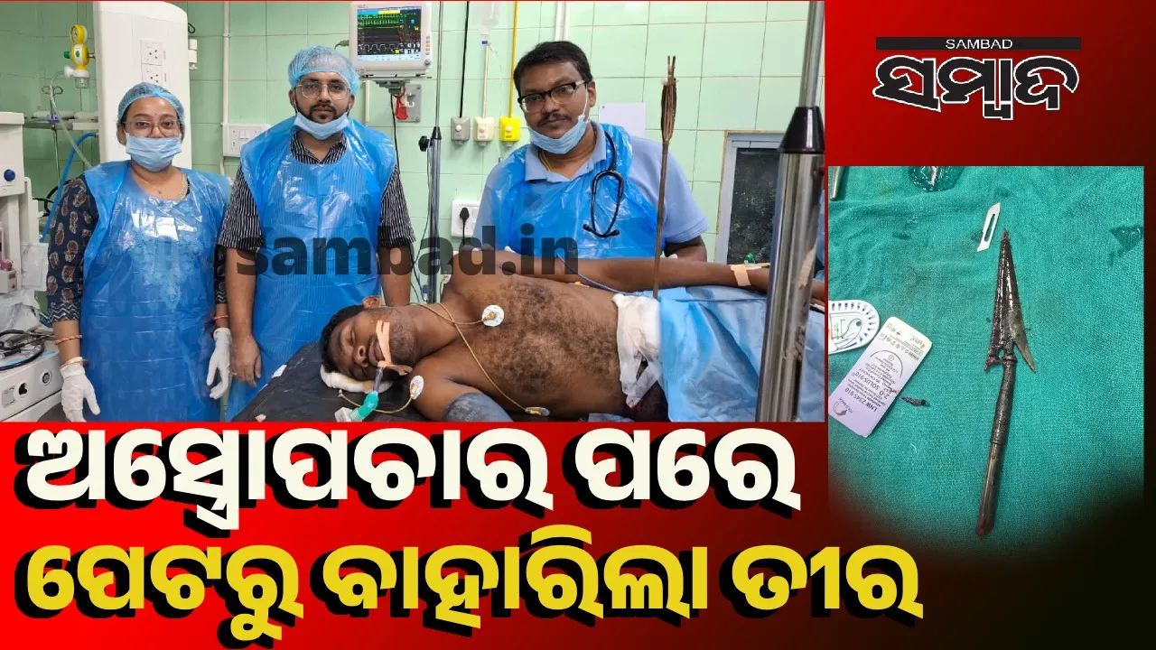  ବଡ଼ ସଫଳତା: ଅନ୍ତଃନଳୀ କାଟି ଡାକ୍ତରୀ ଟିମ୍‌ ବାହାର କଲେ ତୀର