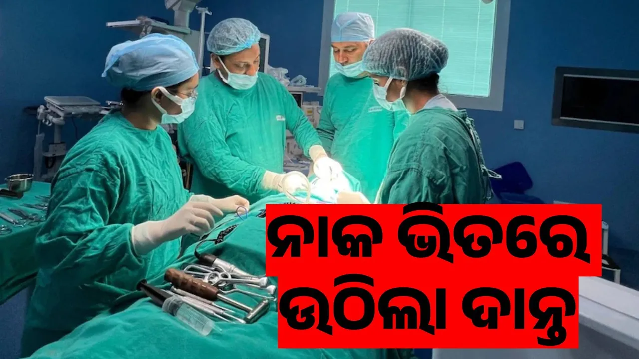  ଶିଶୁ ନାକର ଅସ୍ତ୍ରୋପଚାର କରି ଅସ୍ୱାଭାବିକ ଭାବରେ ବଢ଼ୁଥିବା ଦାନ୍ତକୁ ବାହାର କଲେ ଡାକ୍ତର