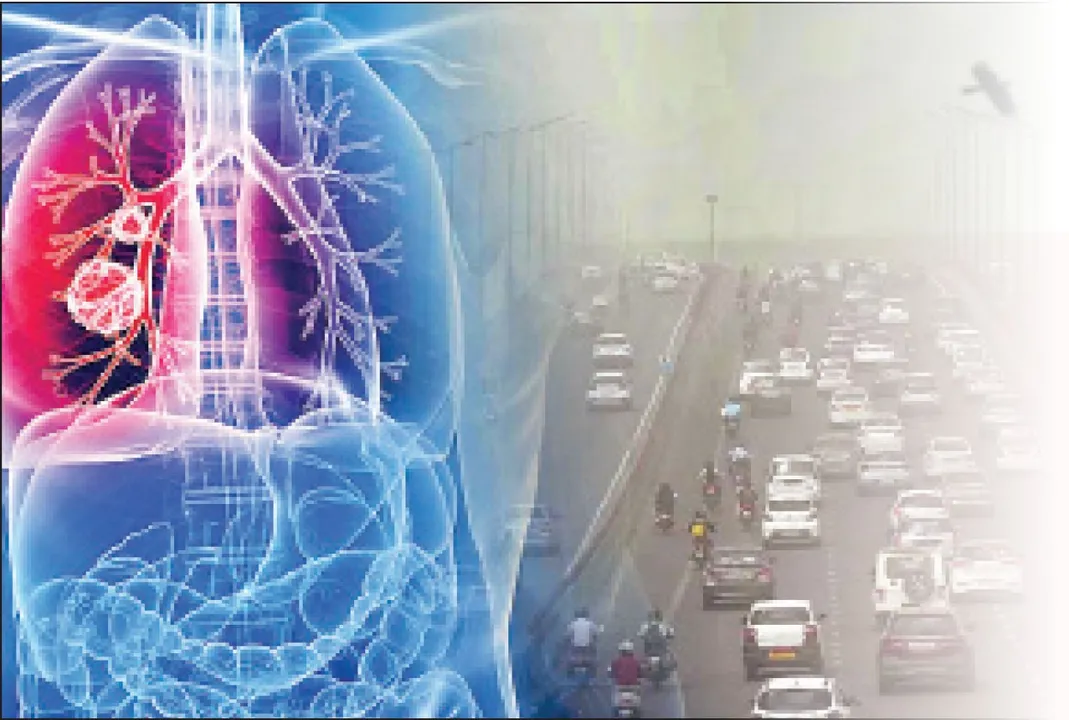  'If you can, leave Delhi for 6-8 weeks': ଫୁସ୍‌ଫୁସ୍‌ ବିଶେଷଜ୍ଞଙ୍କ ଚେତାବନୀ: ‘ଯଦି ପାରୁଛନ୍ତି, ୬-୮ ସପ୍ତାହ ଦିଲ୍ଲୀ ଛାଡ଼ନ୍ତୁ’