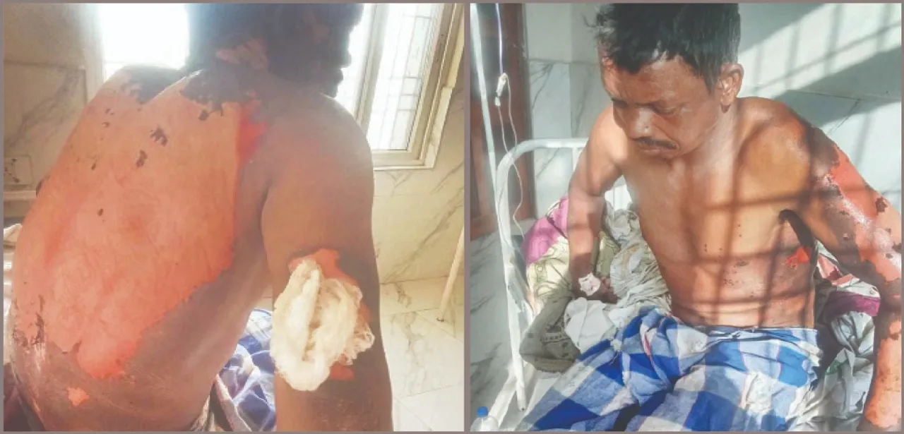  Dadan Sardar's brutal incident: ଦାଦନ ସର୍ଦ୍ଦାରର ବର୍ବରକାଣ୍ଡ: ଟ୍ରେନ୍‌ରୁ ଉଠାଇ ନେଇ କରେଣ୍ଟ ଦେଲେ, ତେଲ ଢାଳି ଦିଆସିଲି ମାରିଦେଲେ