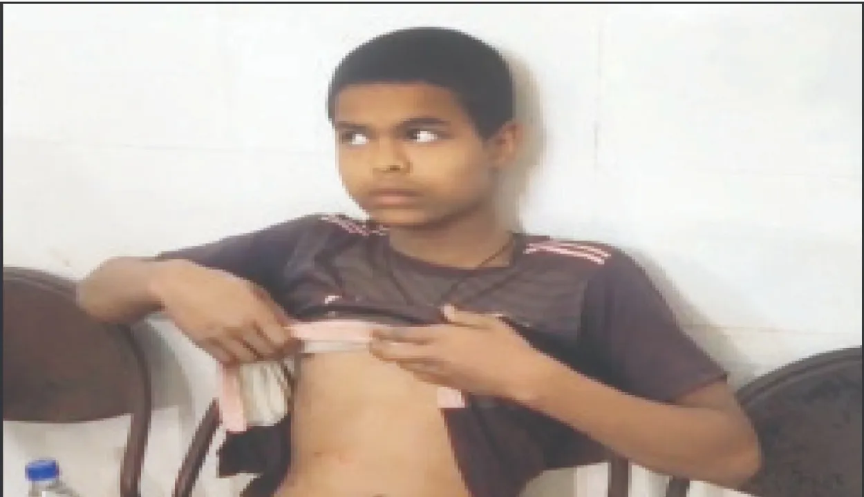  Minor boy saves life: ଭାଲୁ ସହ ଲଢ଼ି ଜୀବନ ବଞ୍ଚାଇଲେ ନାବାଳକ