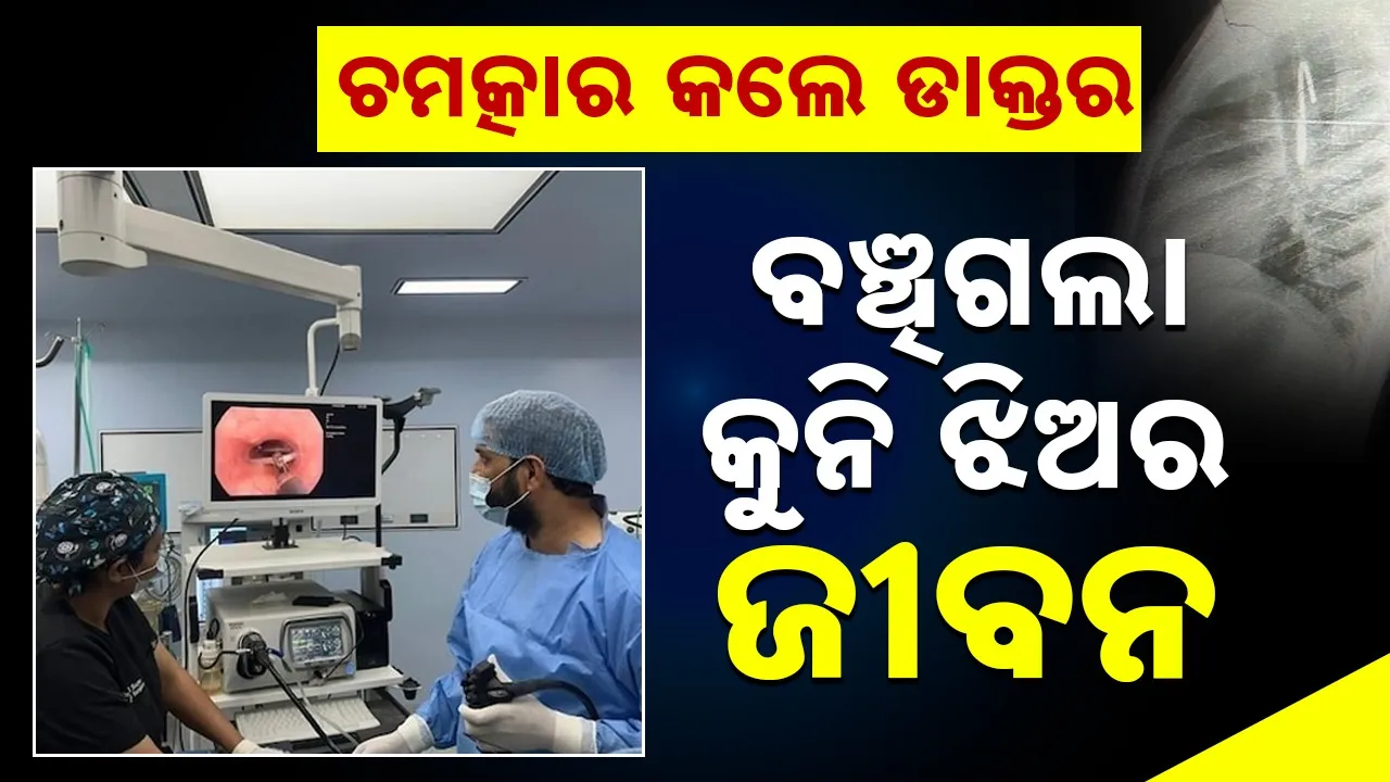  Government Doctors Save Girl Life: ବିନା ଅପରେସନରେ କୁନି ଝିଅ ପେଟରୁ ବାହାରିଲା ଲୁହା ହୁକ୍, ସରକାରୀ ଡାକ୍ତର ସାଜିଲେ ଭଗବାନ