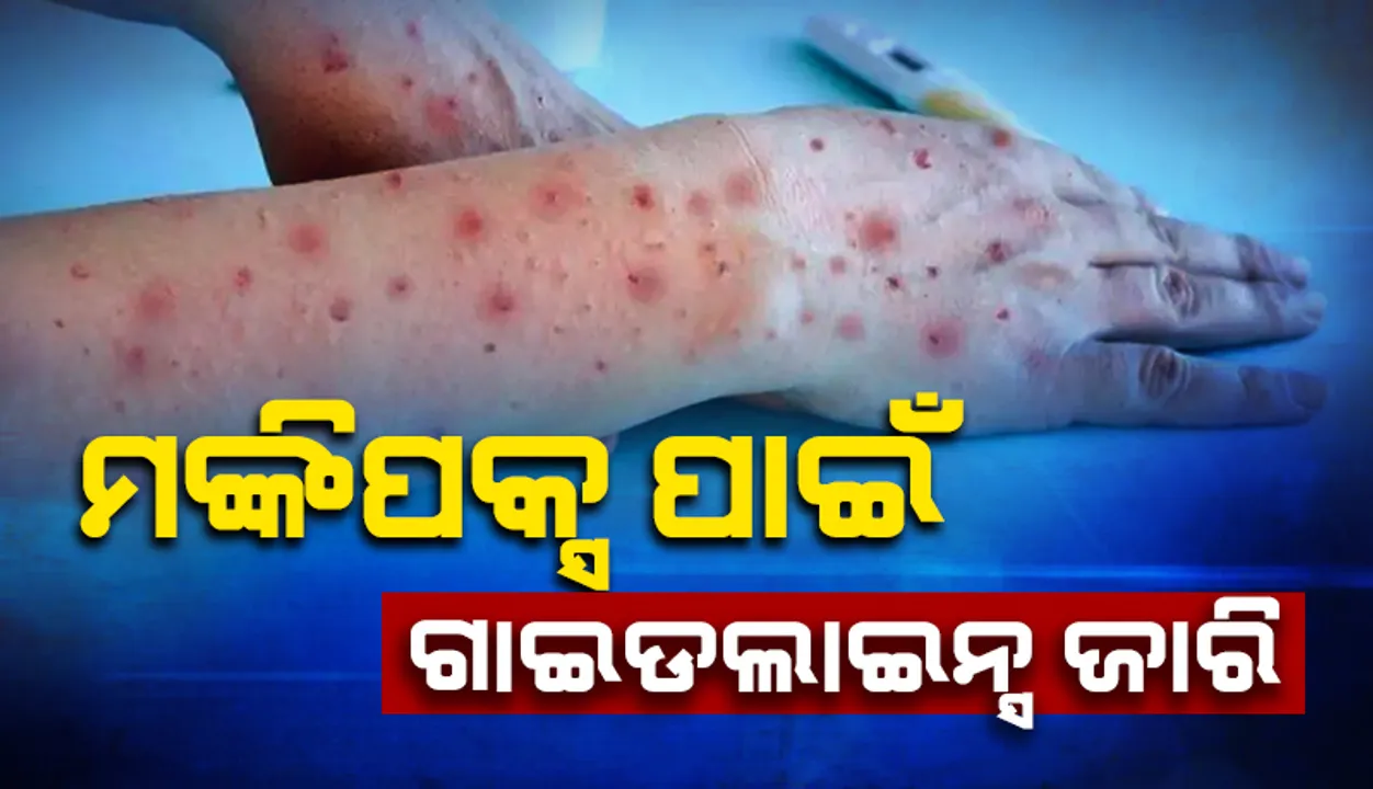  ମଙ୍କିପକ୍ସ ପାଇଁ ଗାଇଡଲାଇନ ଜାରି