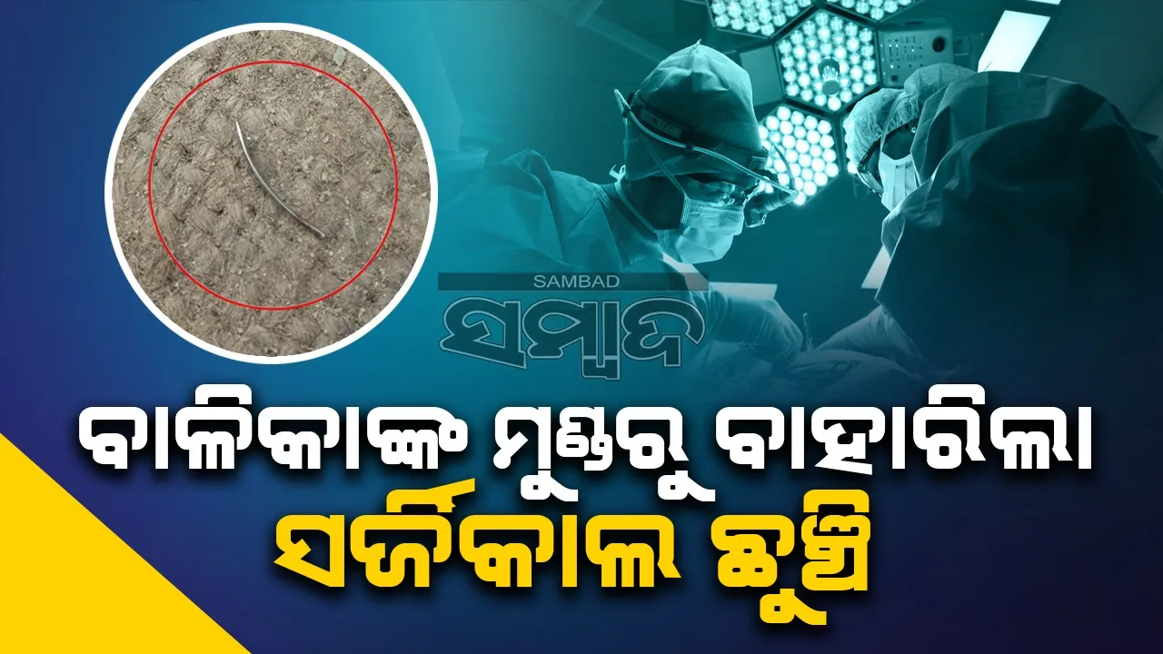  ଅସ୍ତ୍ରୋପଚାର ପରେ ବାଳିକାଙ୍କ ମୁଣ୍ଡରୁ ବାହାରିଲା ସର୍ଜିକାଲ ଛୁଞ୍ଚି
