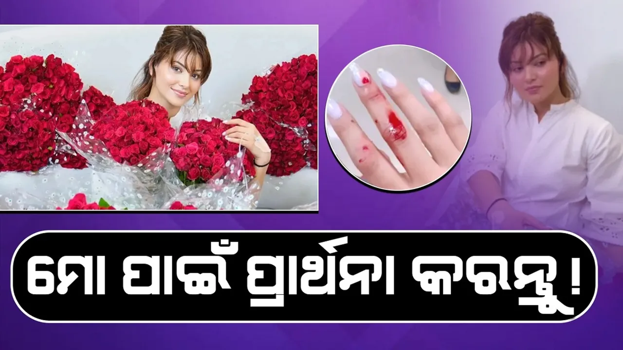  ସାମାନ୍ୟ ଆଘାତ ପାଇଁ ଡାକ୍ତରଖାନା ଯିବାରୁ ଉର୍ବଶୀଙ୍କୁ ଟ୍ରୋଲ କଲେ ଲୋକେ