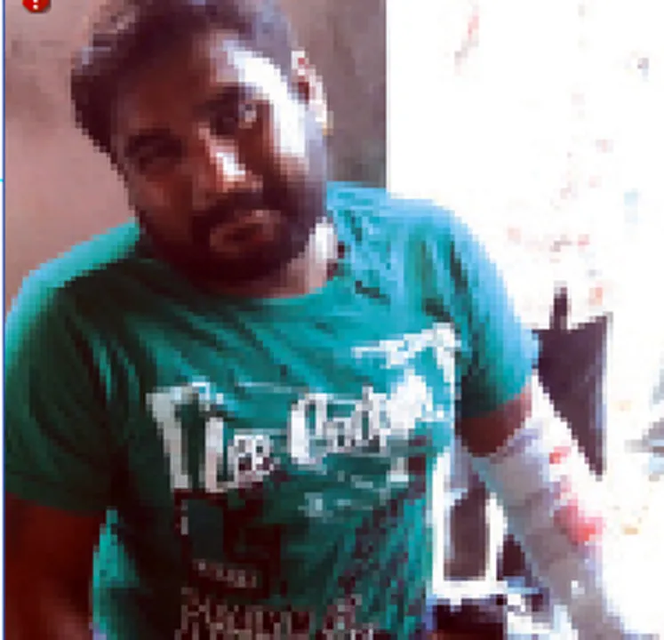  ବାଇକ୍‌ ଧକ୍କାରେ ମାଙ୍କଡ଼ ମୃତ, ଆରୋହୀ ଆହତ