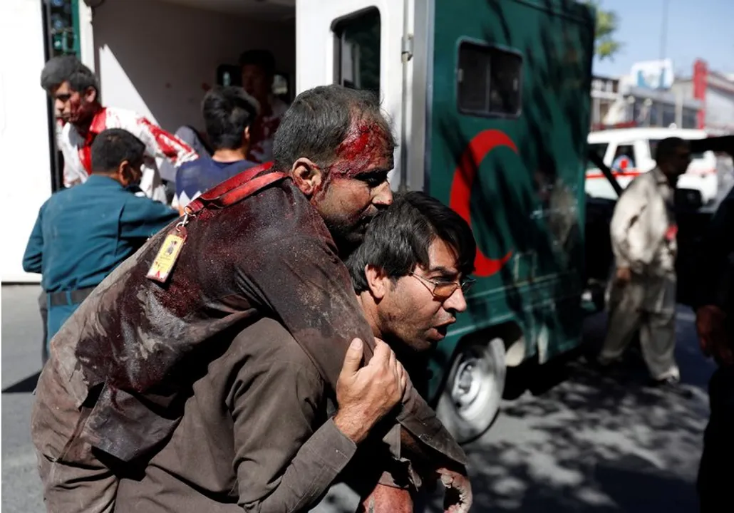  ATTENTION EDITORS - VISUAL COVERAGE OF SCENES OF INJURY OR DEATHAn Afghan man carries an injured man to a hospital after a blast in Kabul, Afghanistan May 31, 2017.  REUTERS/Mohammad Ismail - RTX38B3A 
