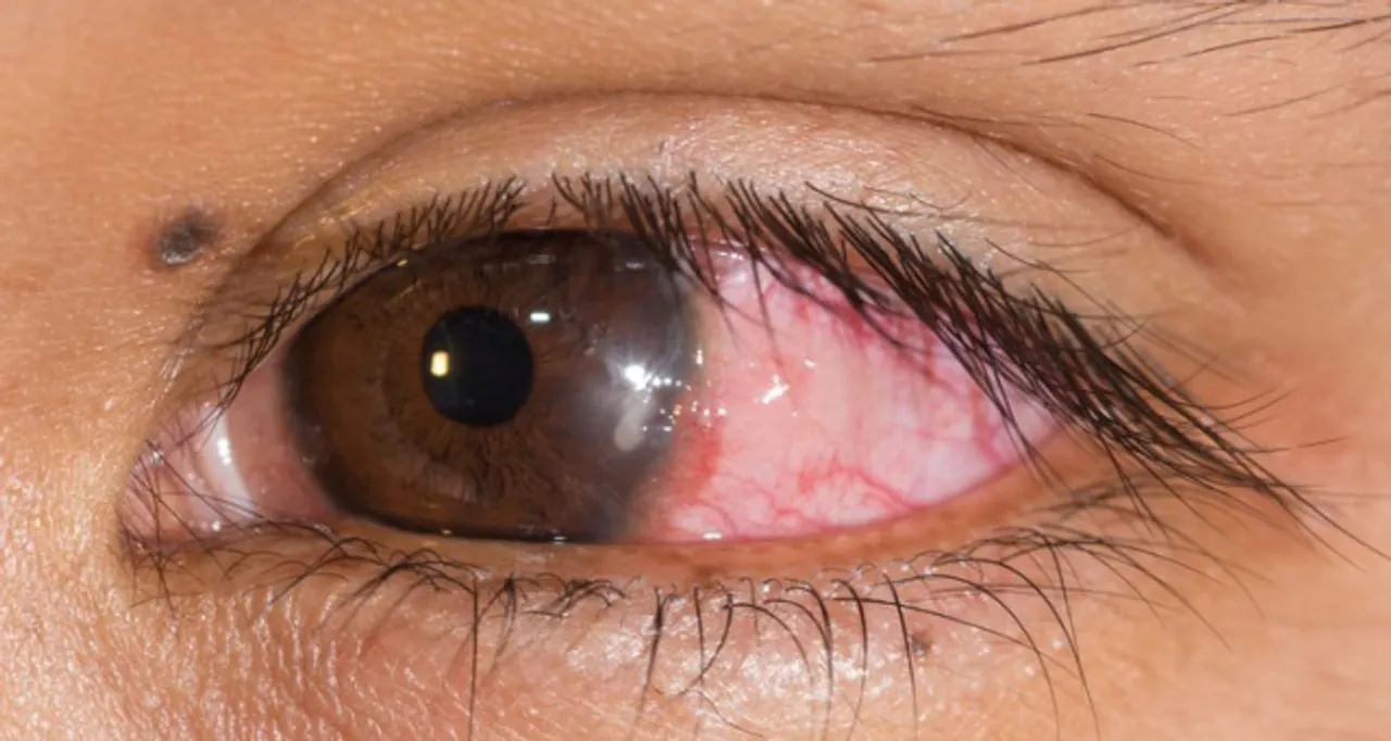  photo--optometry-cet.com 