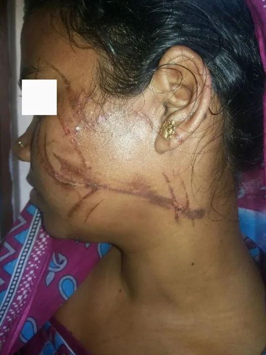  ସ୍ୱାମୀର ତାଓ୍ଵା ମାଡ଼ରେ ସ୍ତ୍ରୀ ଗୁରୁତର