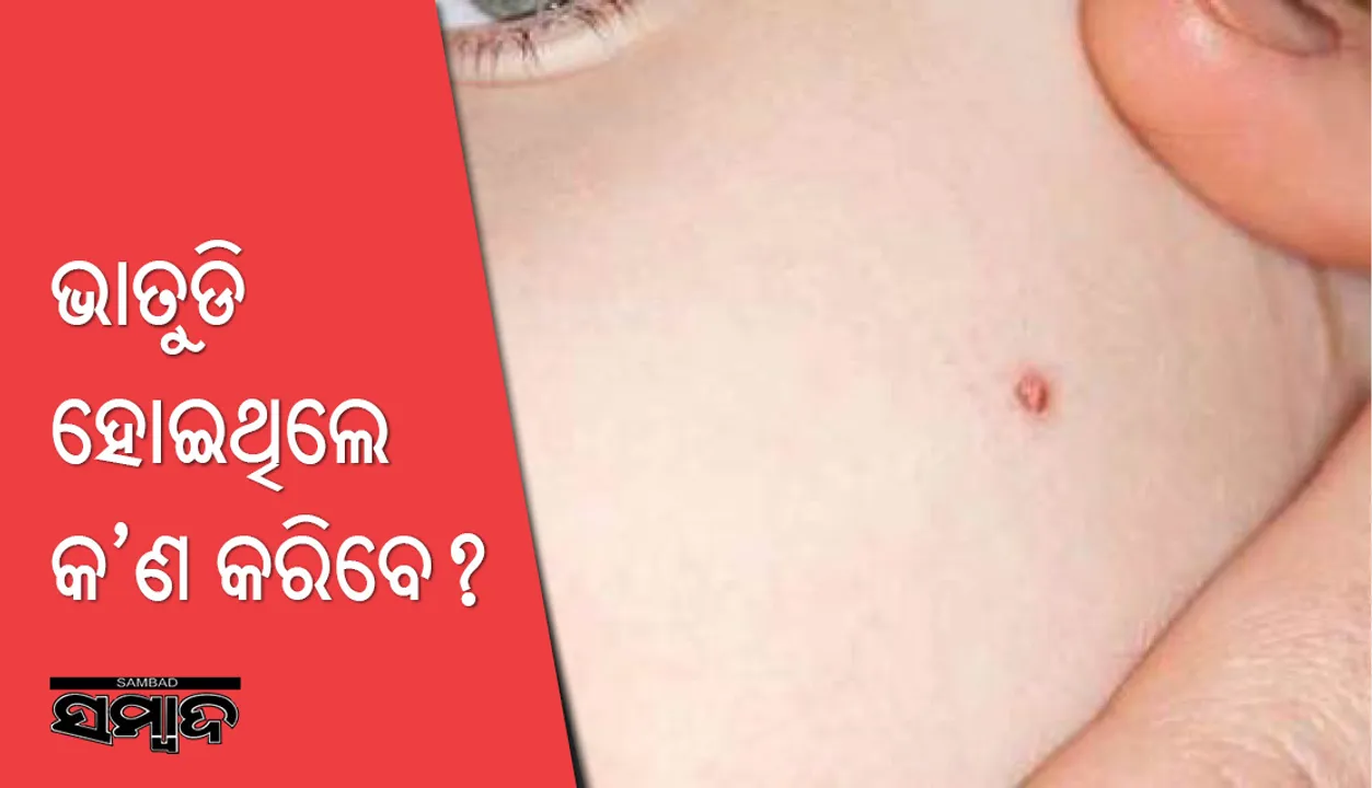  ଭାତୁଡ଼ିକୁ ଶରୀରରୁ ଦୂରେଇବାପାଇଁ କରନ୍ତୁ ଏହି ଉପାୟ