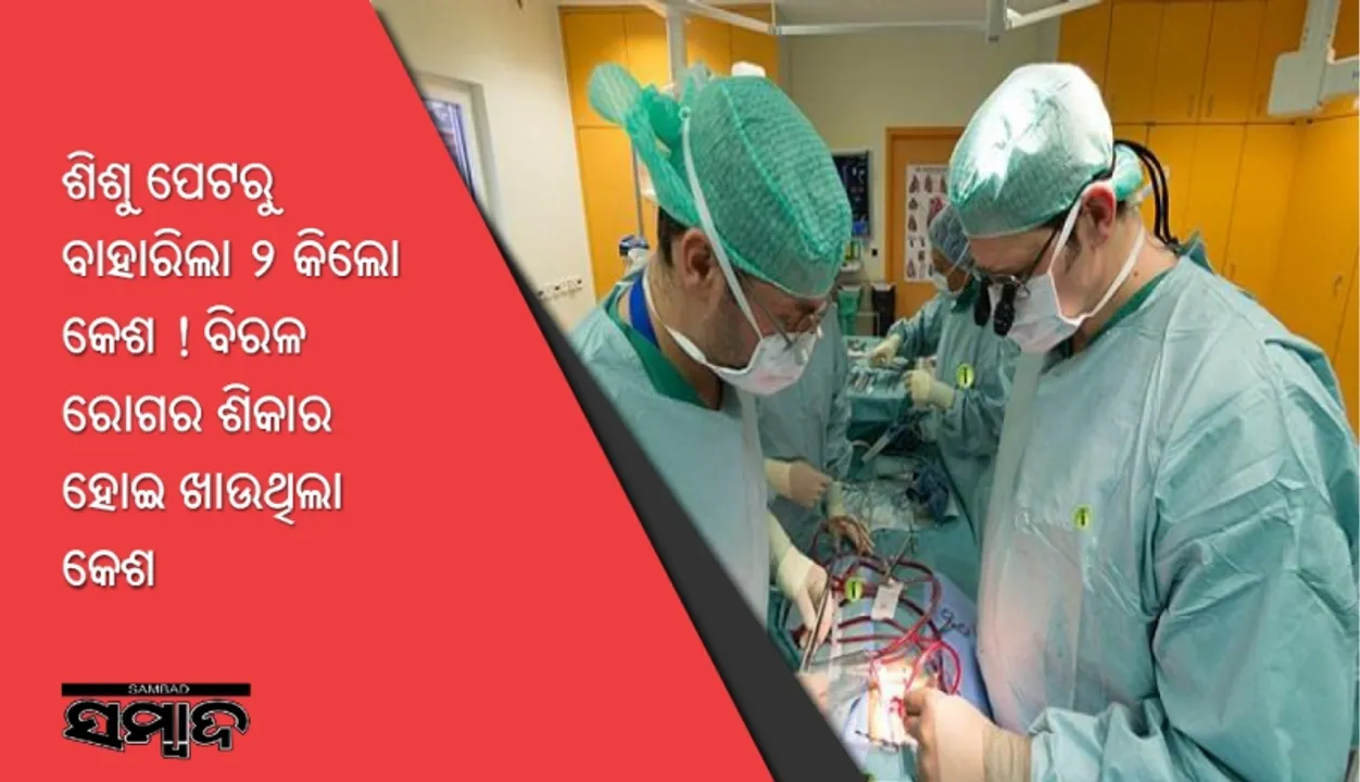 ଶିଶୁ ପେଟରୁ ବାହାରିଲା ୨ କିଲୋ କେଶ ! ବିରଳ ରୋଗର ଶିକାର ହୋଇ ଖାଉଥିଲା କେଶ