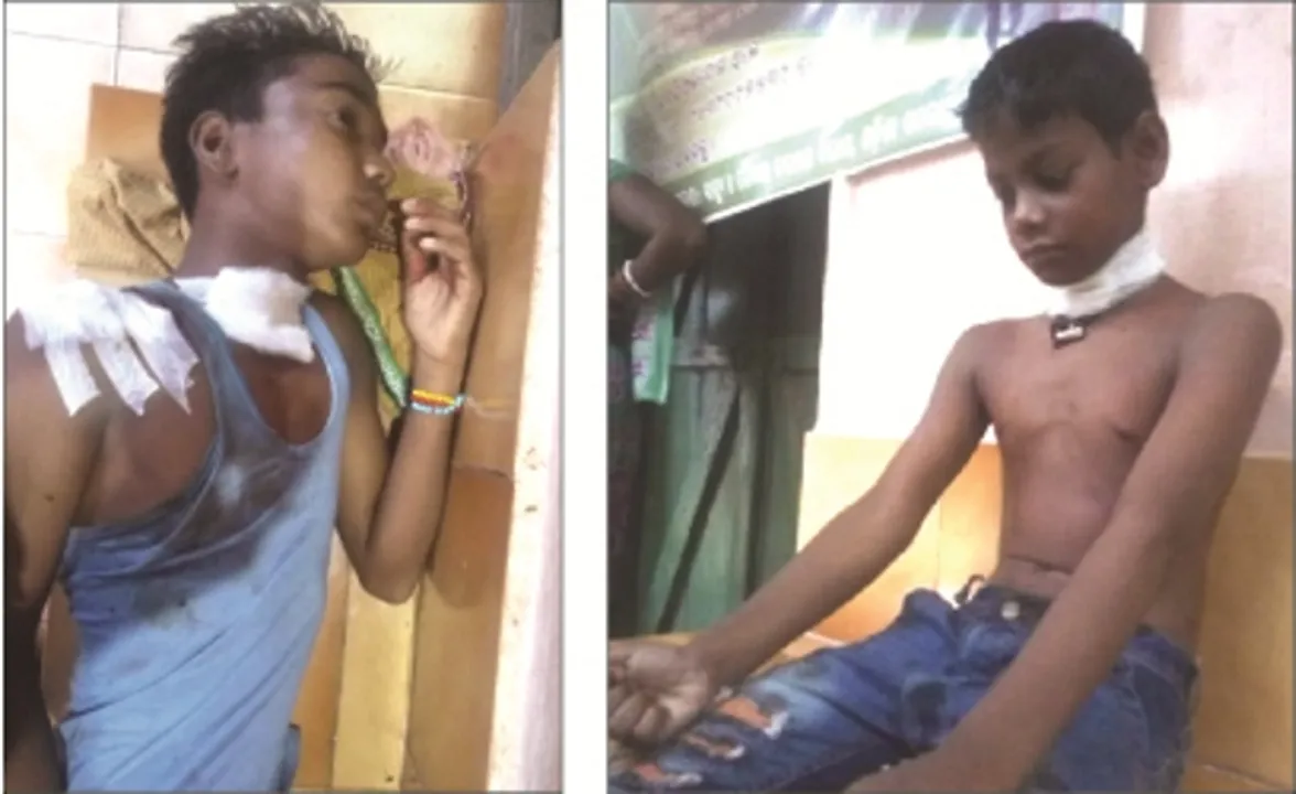 ସାରସକଣା ସରସ୍ୱତୀ ଶିଶୁ ମନ୍ଦିରରେ ଅଘଟଣ : ଅଜଣା ଦୁର୍ବୃତ୍ତର ଆକ୍ରମଣରେ ୨ ଛାତ୍ର ଗୁରୁତର