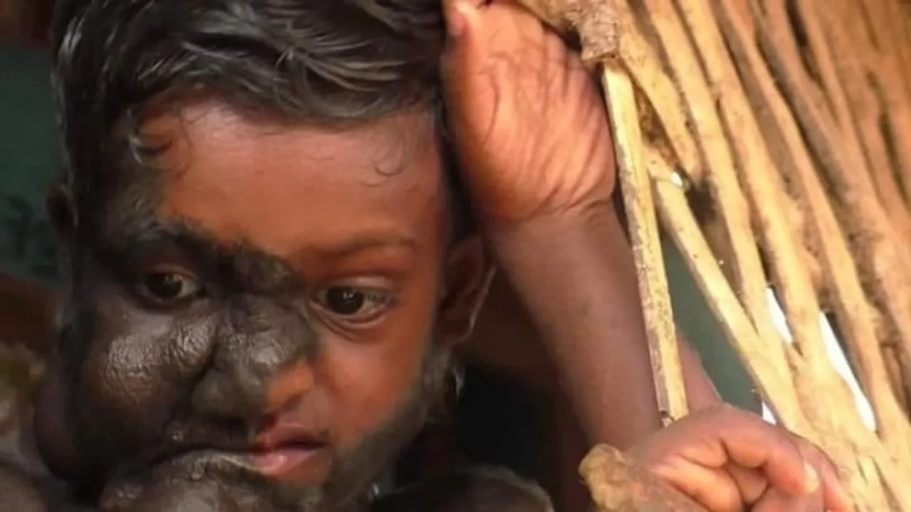  ଏମ୍‌କେସିଜିରେ ଚିକିତ୍ସା ଆରମ୍ଭ : ଗୁରୁବାର ‘କାହ୍ନା’ର ଅସ୍ତ୍ରୋପଚାର