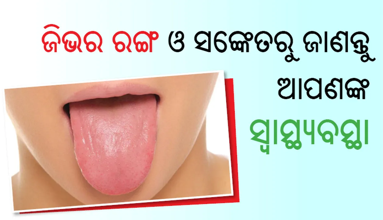  ଜିଭର ରଙ୍ଗ ଓ ସଙ୍କେତରୁ ଜାଣନ୍ତୁ ଆପଣଙ୍କ ସ୍ୱାସ୍ଥ୍ୟବସ୍ଥା