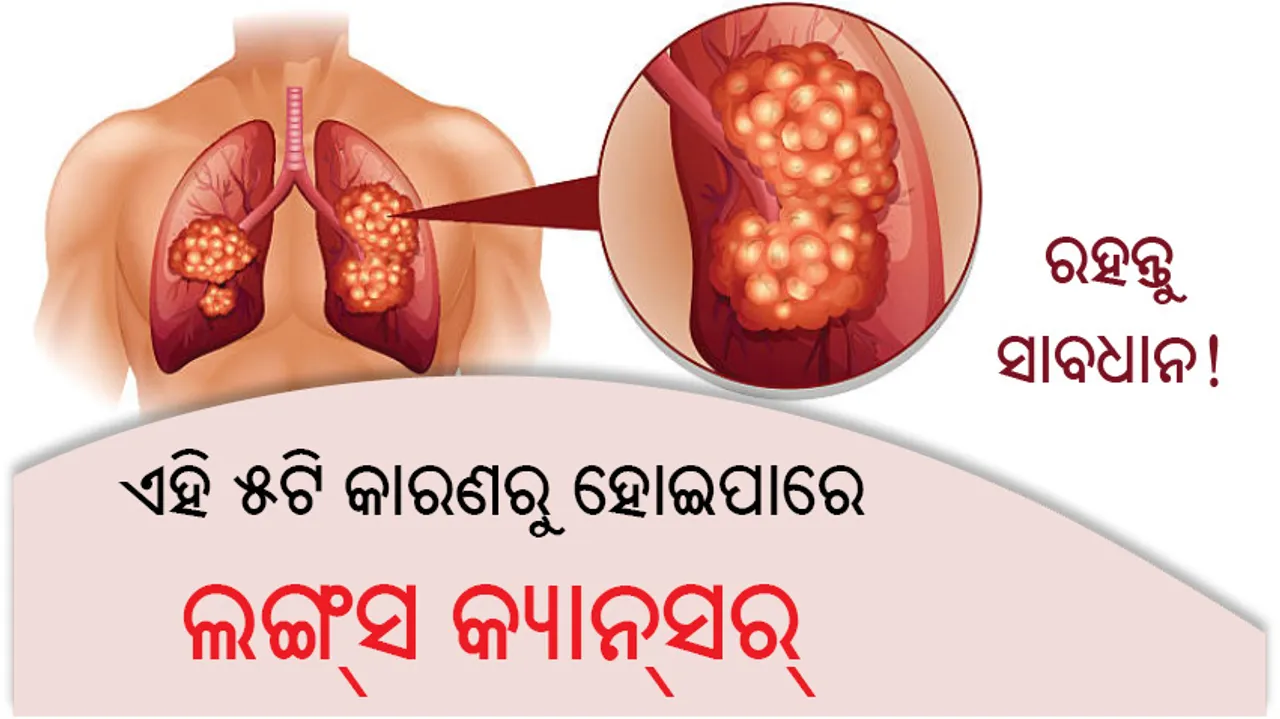  ଏହି ୫ଟି କାରଣରୁ ହୋଇପାରେ ଲଙ୍ଗ୍‌ସ କ୍ୟାନ୍‌ସର୍‌, ରହନ୍ତୁ ସାବଧାନ!