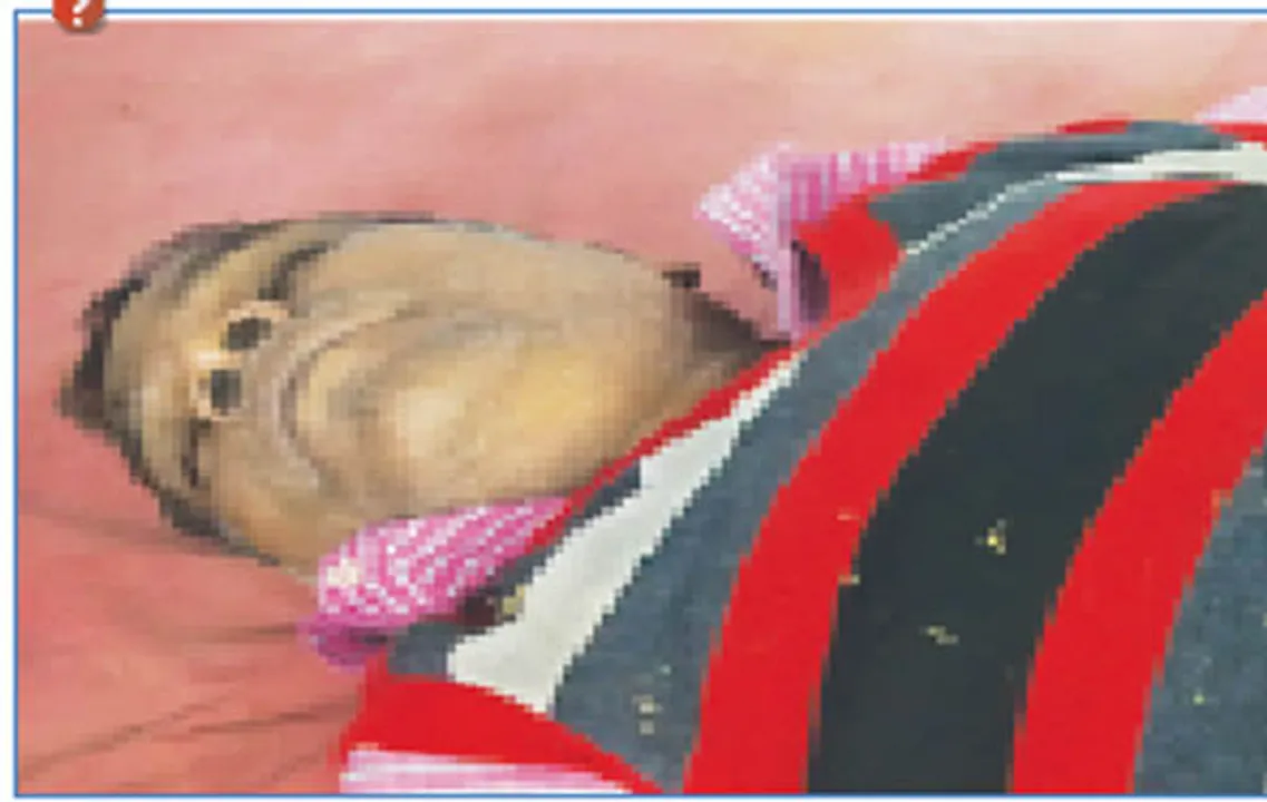  ତଳେ ପଡ଼ି ଯାଇ ଖଣି କର୍ମଚାରୀଙ୍କ ମୃତ୍ୟୁ