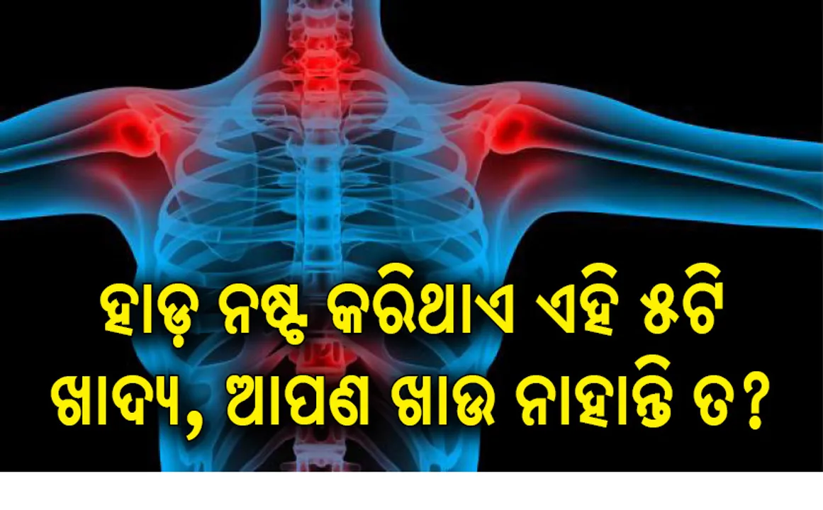  ଆପଣଙ୍କ ଶରୀରର ହାଡ଼ ନଷ୍ଟ ହେବାର ବିପଦକୁ ବଢ଼ାଇଥାଏ ଏହି ୫ଟି ଖାଦ୍ୟ, ଆପଣ ଖାଉ ନାହାନ୍ତି ତ?