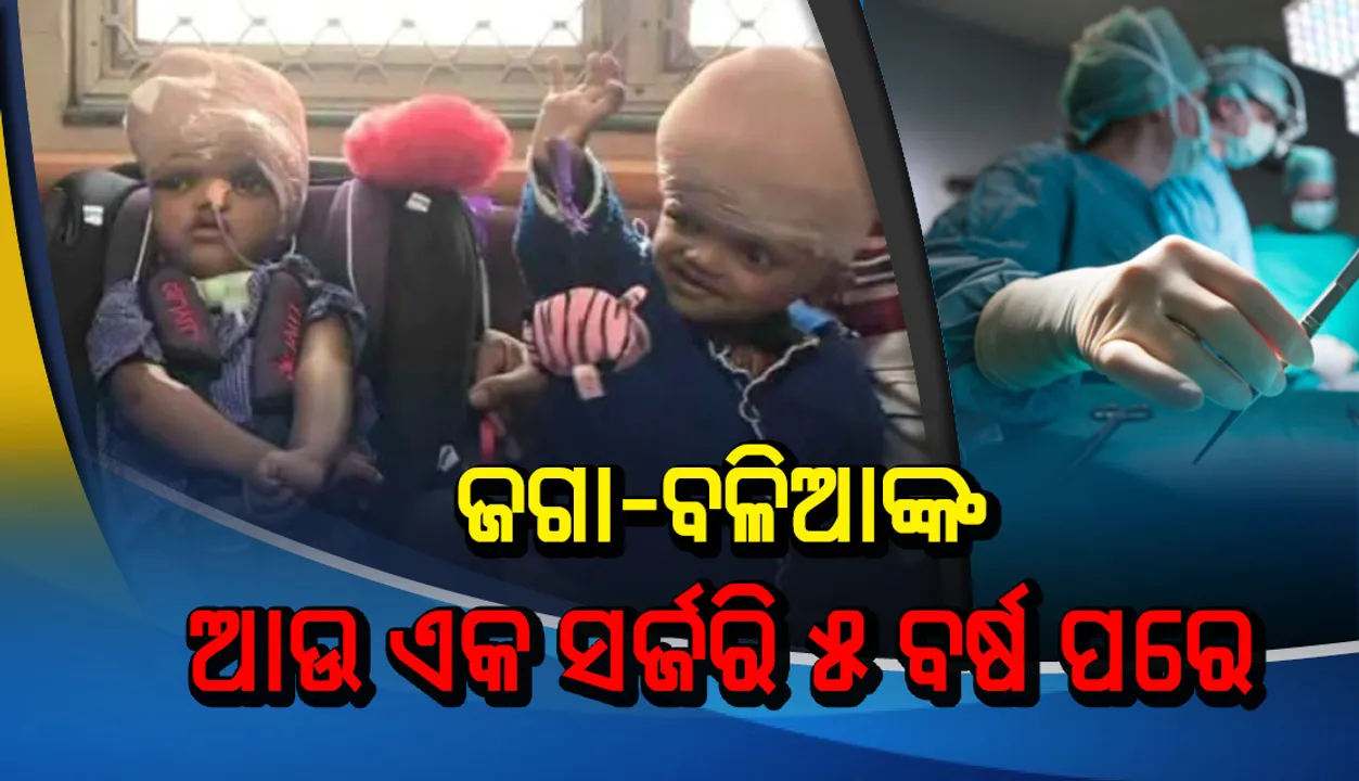  ଜଗା-ବଳିଆଙ୍କ ଆଉ ଏକ ସର୍ଜରି ୫ ବର୍ଷ ପରେ