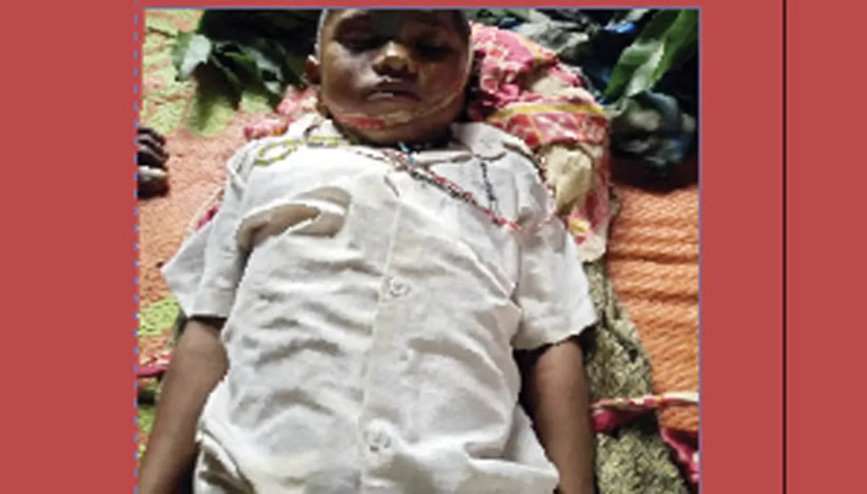  ବିଷଧର ସାପ କାମୁଡ଼ାରେ ୩ ମୃତ