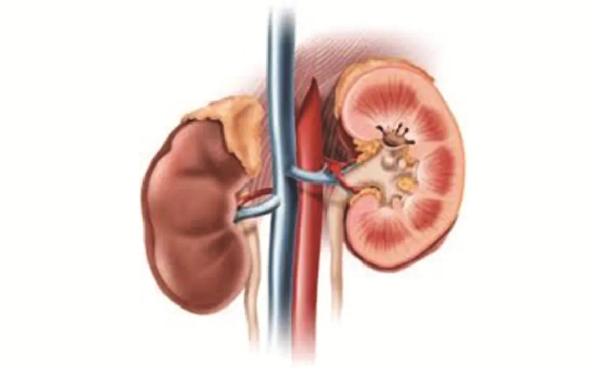  ଧର୍ମଶାଳା: ଚିହ୍ନଟ ହେଲେ ୨୦ କିଡ୍‌ନି​ ରୋଗୀ