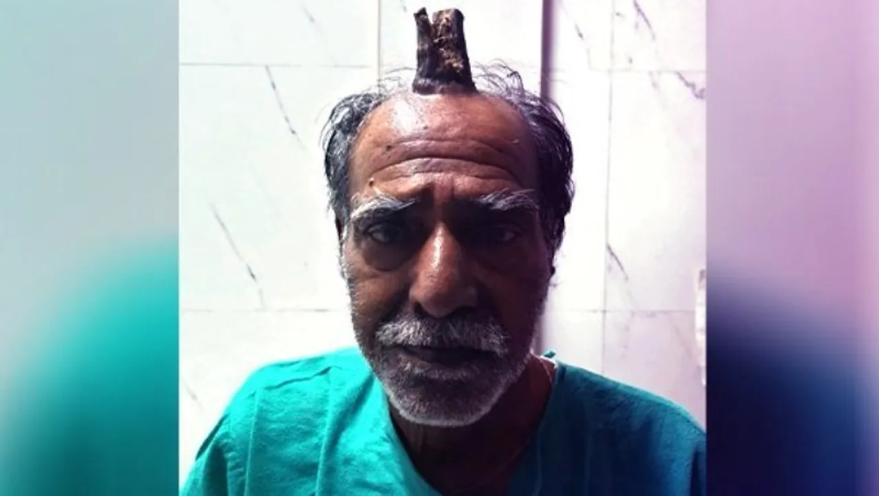  oneindia.com 