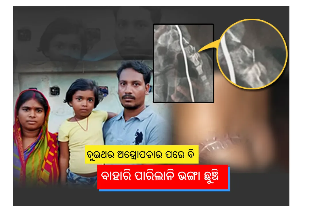  ଫାର୍ମସିଷ୍ଟଙ୍କ ଭୁଲ ହେତୁ ୨ ମାସ ହେବ ଶିଶୁ ଶରୀରରେ ରହିଥିବା ଭଙ୍ଗା ଛୁଞ୍ଚି ଅସ୍ତ୍ରୋପଚାର ପରେ ବି ବାହାରି ପାରୁନାହିଁ ! ଚିନ୍ତାରେ ପରିବାର