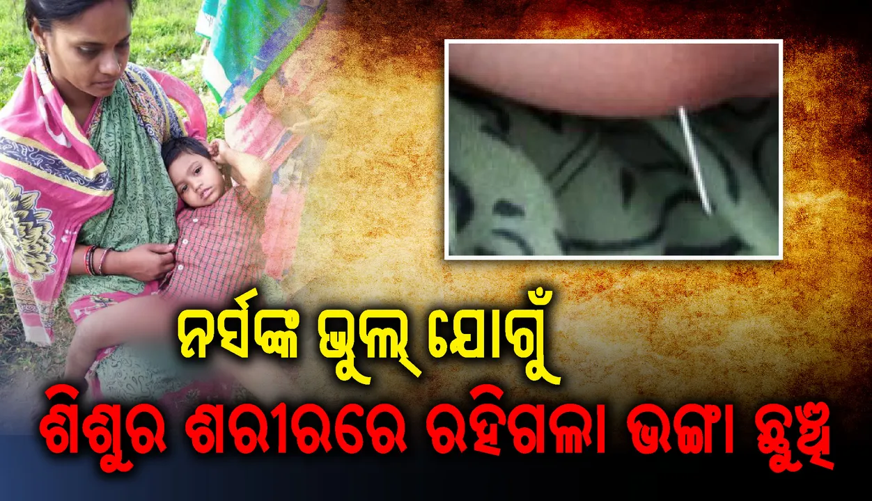  ଏକମାସ ପୂର୍ବେ ନର୍ସଙ୍କ ଭୁଲ ଯୋଗୁଁ ଶିଶୁ ଶରୀରରେ ରହିଯାଇଥିବା ଇଂଜେକସନର ଭଙ୍ଗା ଛୁଞ୍ଚି,ମଳଦ୍ୱାର ଓ ଯୌନାଙ୍ଗ ମଧ୍ୟବର୍ତ୍ତୀ ସ୍ଥାନରୁ ବାହାରିଲା