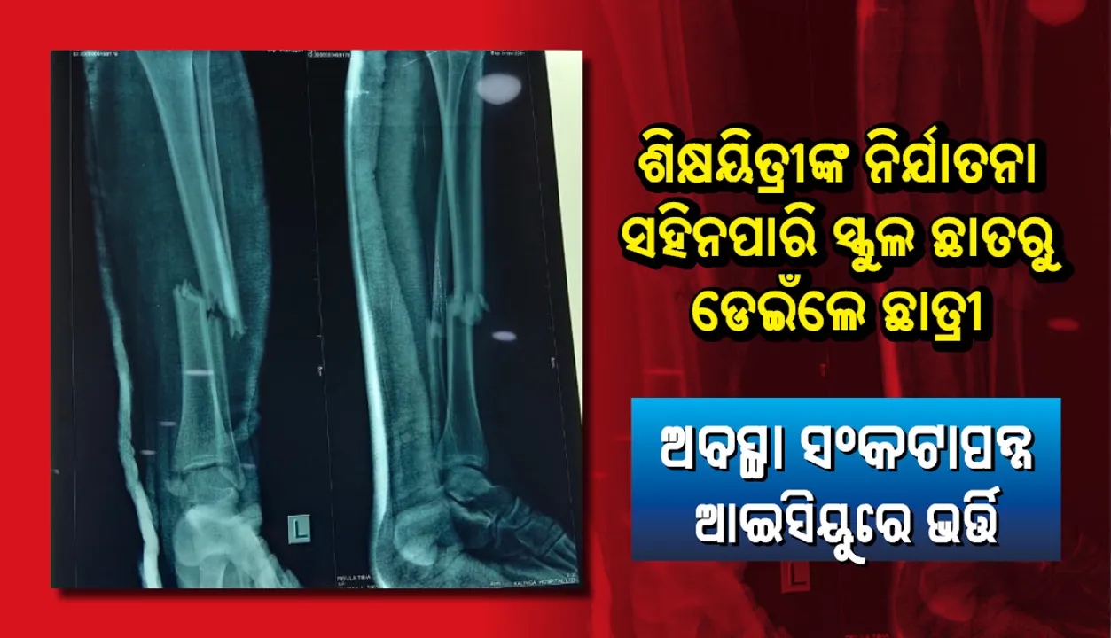  ପିଇଟି ଶିକ୍ଷୟିତ୍ରୀଙ୍କ ନିର୍ଯାତନା ସହି ପାରିଲେନି, ସ୍କୁଲର ୩ ମହଲା ଛାତରୁ ଡେଇଁ ପଡ଼ିଲେ ଛାତ୍ରୀ