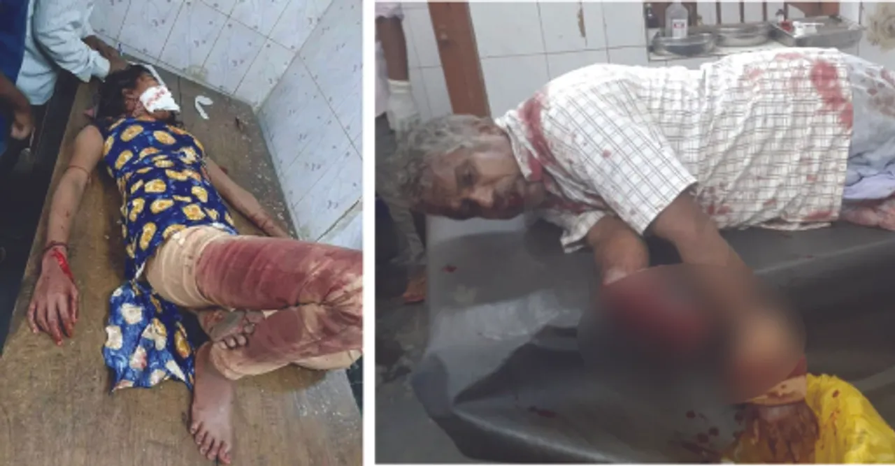  ବିଫଳ ପ୍ରେମିକର ଉନ୍ମତ୍ତକାଣ୍ତ : ବାପ, ଝିଅକୁ ଭୁଜାଲିରେ ଆକ୍ରମଣ