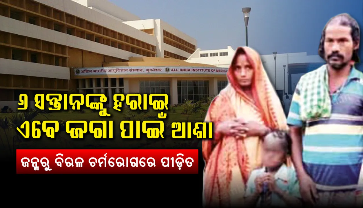 ୬ ସନ୍ତାନଙ୍କୁ ହରାଇଥିଲେ, ଏବେ ଜଗା ପାଇଁ ଆଶା : ଜନ୍ମରୁ ବିରଳ ଚର୍ମରୋଗରେ ପୀଡ଼ିତ, ଭୁବନେଶ୍ବର ଏମ୍‌ସ୍‌କୁ ନେବା ପାଇଁ ପ୍ରସ୍ତୁତି