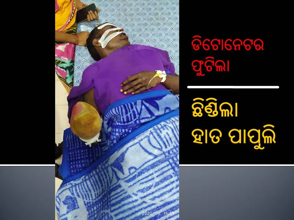  ମାଛ ମାରିବାକୁ ଯାଇଥିବା ବେଳେ ଫୁଟିଲା ଡିଟୋନେଟର, ମାଛ ଧରାଳିଙ୍କ ହାତ ପାପୁଲି ଛିଣ୍ଡିଲା