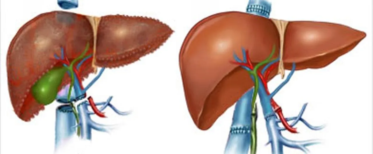  Medindia 