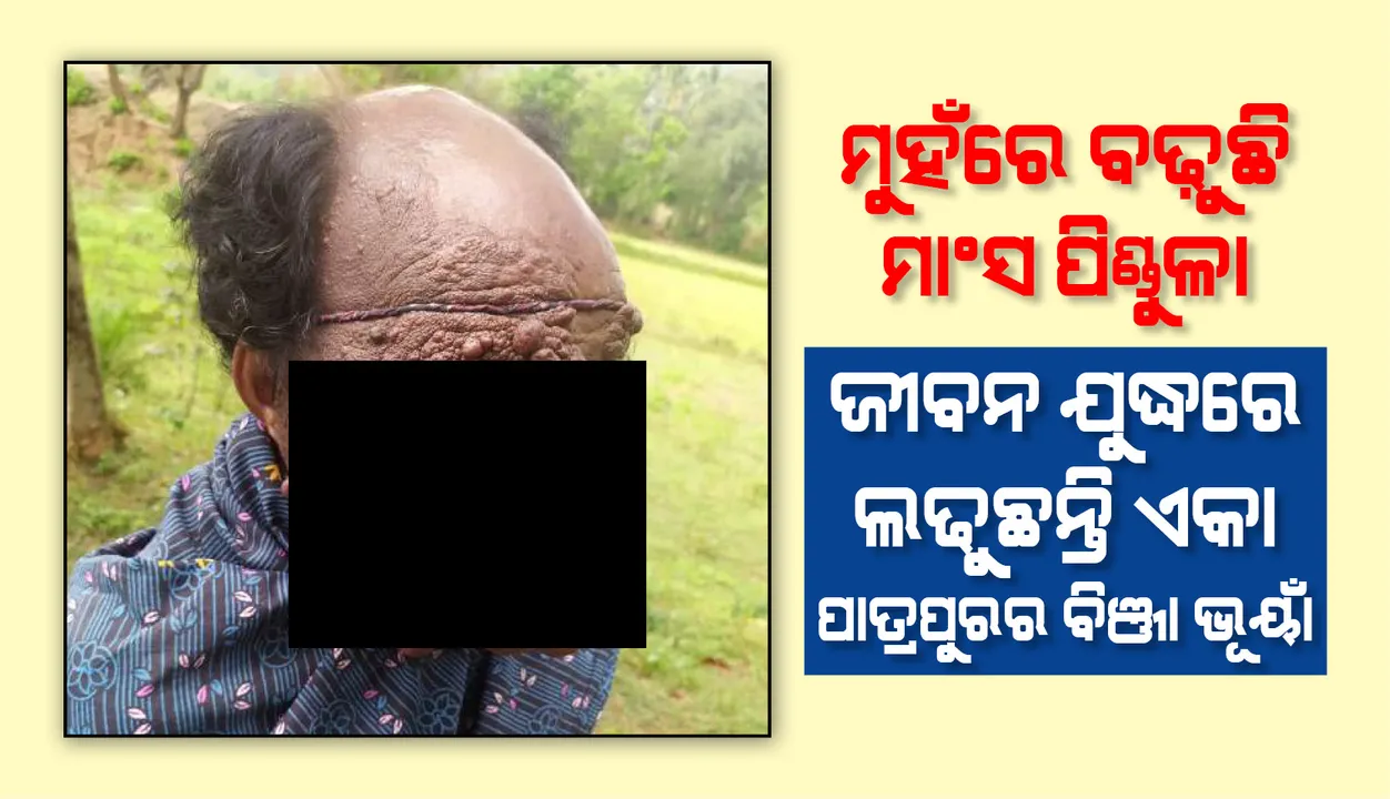  ମୁହଁରେ ବଢୁଛି ମାଂସ ପିଣ୍ଡୁଳା, ଜୀବନ ଯୁଦ୍ଧରେ ଲଢୁଛନ୍ତି ଏକା ପାତ୍ରପୁରର ବିଞ୍ଜା ଭୂୟାଁ