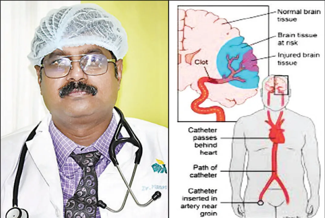  ବ୍ରେନ୍‌ଷ୍ଟ୍ରୋକ୍‌ (ମସ୍ତିଷ୍କାଘାତ)ର ପ୍ରତିକାର ଏବଂ ଚିକିତ୍ସା