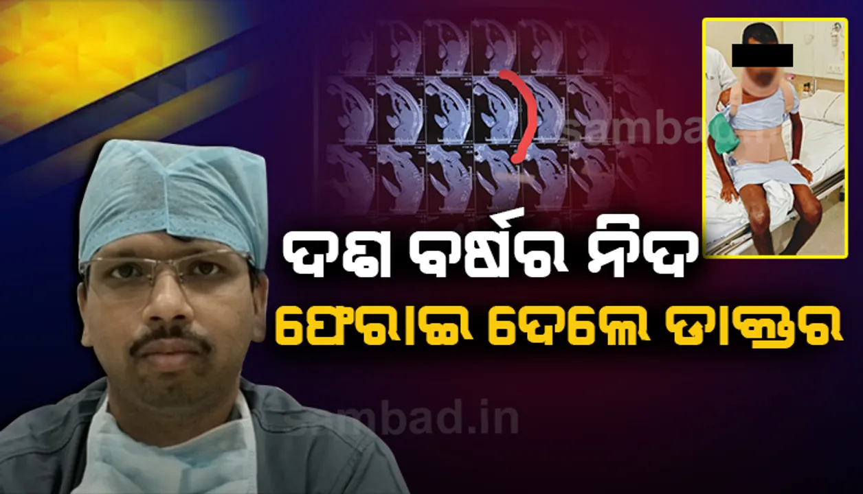  ଓଡ଼ିଶାରେ ବିରଳ ଅପରେସନ୍, ୧୦ ବର୍ଷ ଧରି ଦୁର୍ବିସହ ଜୀବନ ବିତାଉଥିବା ରୋଗୀଙ୍କୁ ମିଳିଲା ନୂଆ ଜୀବନ