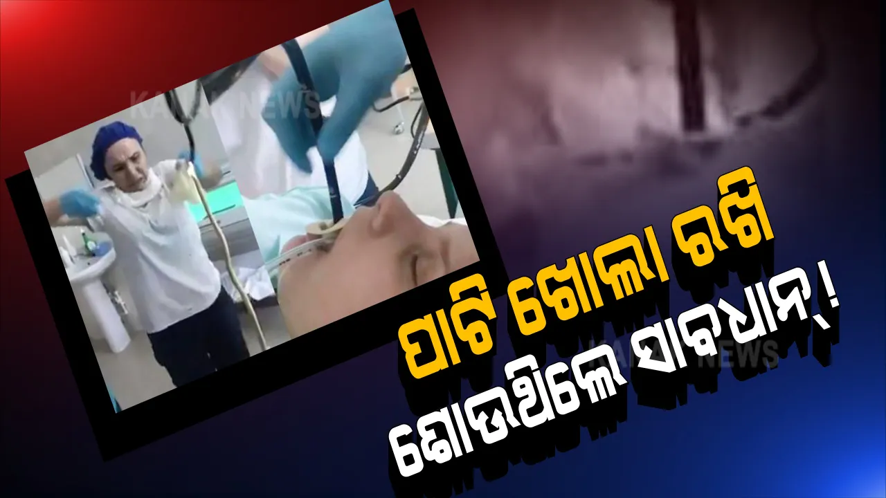  ମହିଳାଙ୍କ ମୁହଁରୁ ୪ଫୁଟ ଲମ୍ବାର ସାପ ବାହାର କଲେ ଡାକ୍ତର